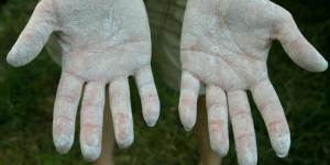 Diatomaceous Earth on hands